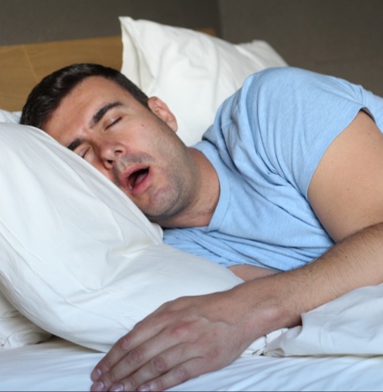 Man sleeping on a bed and snoring.