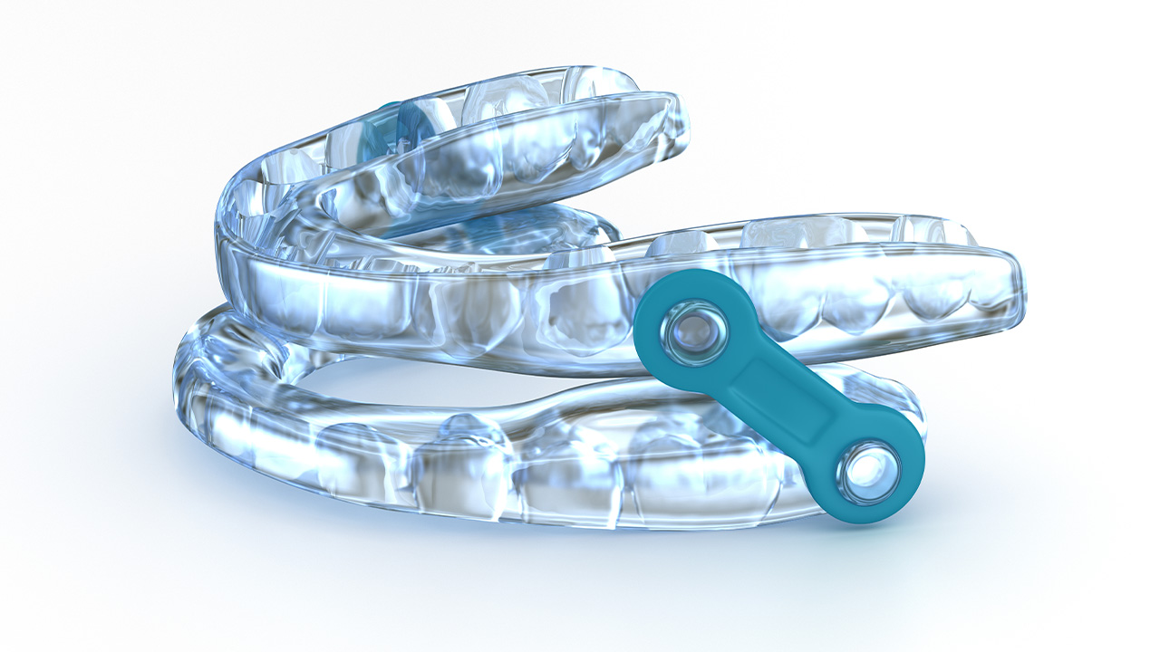 Close-up of oral appliance used to treat sleep apnea