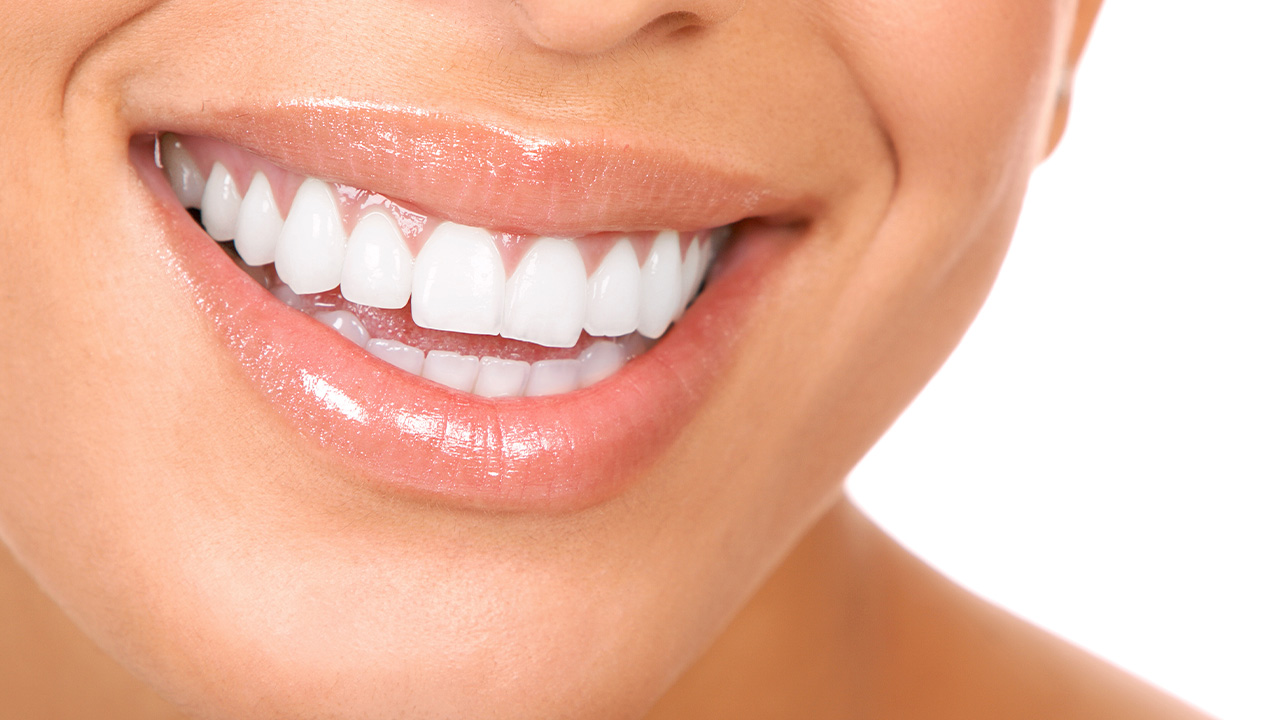 Patient smiling after getting teeth whitening